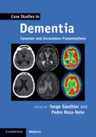 case study dementia