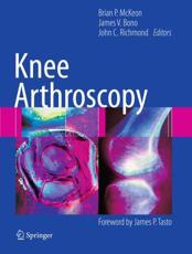 Knee Arthroscopy - Brian P. McKeon, James V. Bono, John C. Richmond