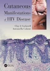 Cutaneous Manifestations of HIV Disease - Clay J. Cockerell, Antoanella Calame