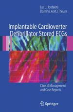 Implantable Cardioverter Defibrillator Stored ECGs - Luc J. Jordaens, Dominic A.M.J. Theuns
