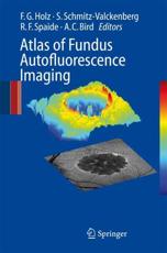 Atlas of Fundus Autofluorescence Imaging - Holz, Frank G.
