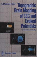 Topographic Brain Mapping of EEG and Evoked Potentials - Duffy, F.H.